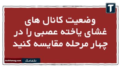 وضعیت کانال های غشای یاخته عصبی را در چهار مرحله مقایسه کنید