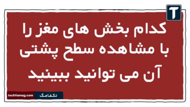 کدام بخش های مغز را با مشاهده سطح پشتی آن می توانید ببینید