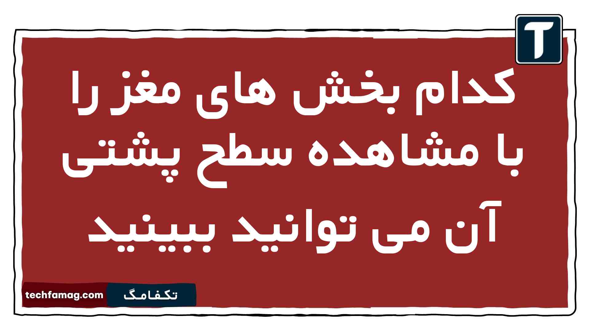 کدام بخش های مغز را با مشاهده سطح پشتی آن می توانید ببینید